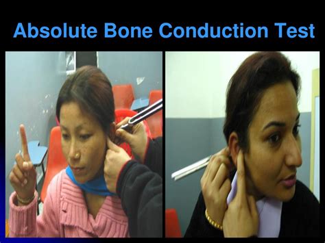 absolute bone conduction test.